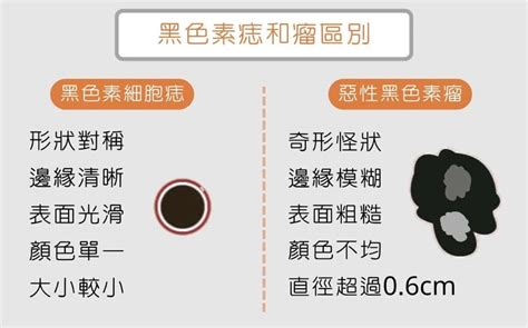 痣 凸起|為什麼臉上的痣越來越多？皮膚科醫師解析長痣原因、。